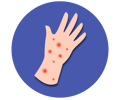 Measles icon 1 (purple)