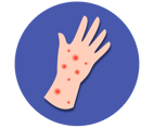 Measles icon 1 (purple)