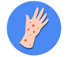 Measles icon 1 (royal blue)
