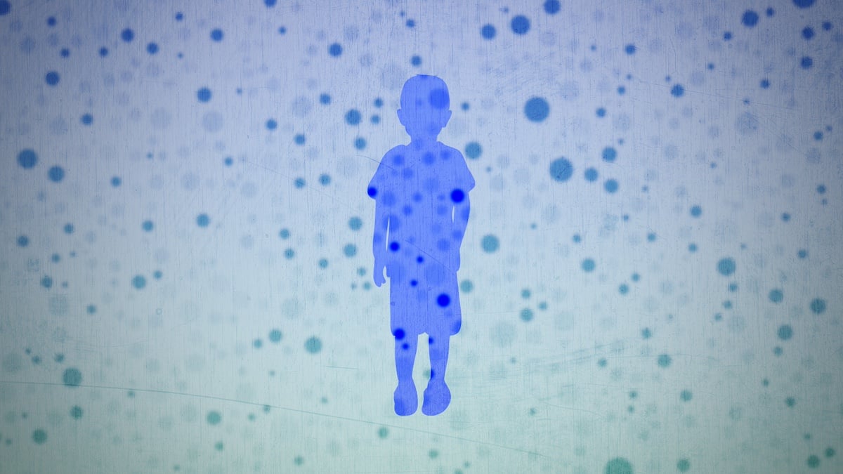The U.S. could lose its measles elimination status. Here’s what that means.